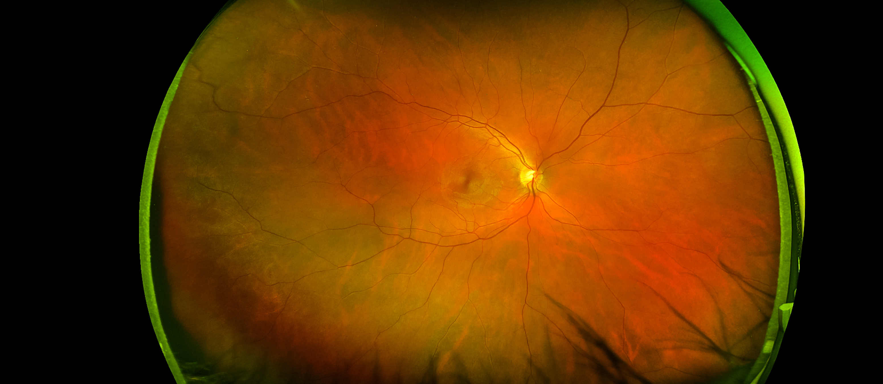 Close up of eye scan